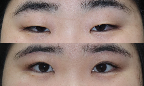 슬라이드14